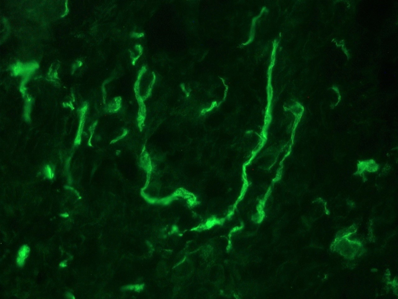 Figure 3. Indirect immunofluorescence staining of human urinary bladder frozen tissue sections with 0566P (diluted 1:500), showing the specific pattern of NCAM/CD56 in the nerves that innervate the tissue. As expected, no reactivity is seen in the epithelial cell compartment, muscle or connective tissue.